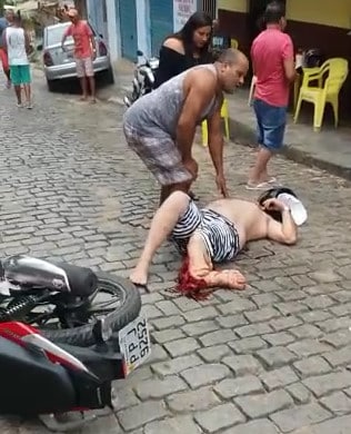 Gruesome Leg Trauma after motorcycle accident 