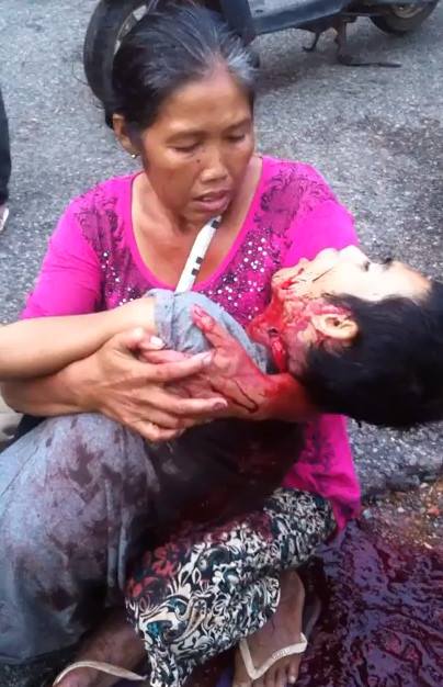  Kid Agonizes and Dies from Having his Throat Slit 