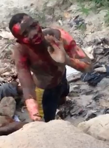 African Thief Keeps Recovering from Stoning After Being Burned