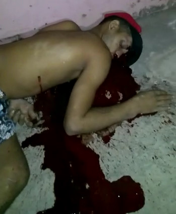 Absolute Bloody Mess Crime Scene .....