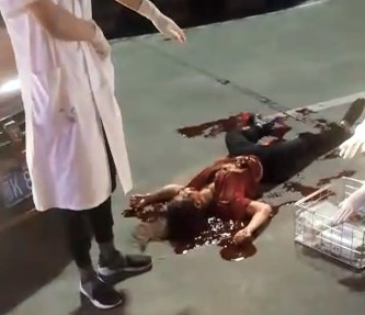 Live Murder + AFTERMATH : Crazy Man Stabbed his Girlfriend