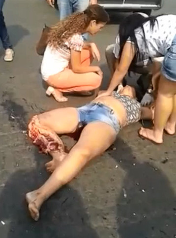 Chubby Girl with Nasty Leg Break 