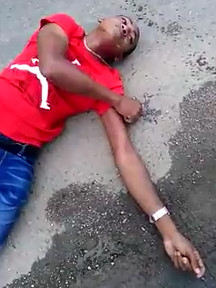 Cyclist Collides with Car then Convulsed on the Street waiting for help to Arrive