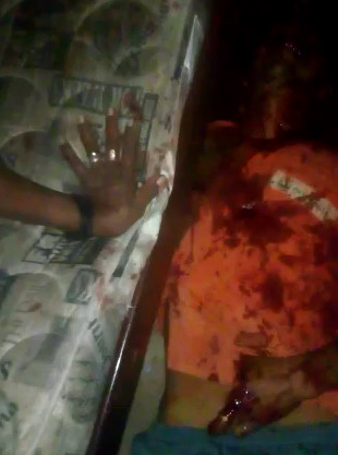 GRUESOME Result of Machete Fight