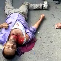 Young Man Gives his very Last Breath