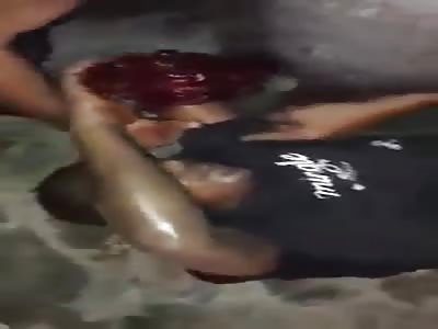 Another stupid Agonizing after Failed Train Track Suicide 