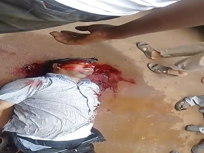 Bloody Aftermath Accident .