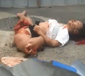 Woman's Vagina Ripped WIDE Open after Motorcycle Accident