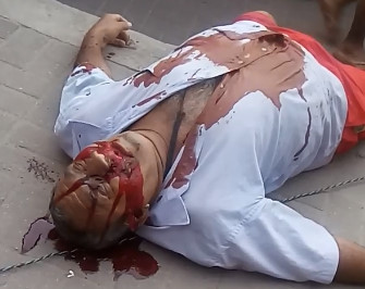 Absolute Bloody Mess Crime Scene