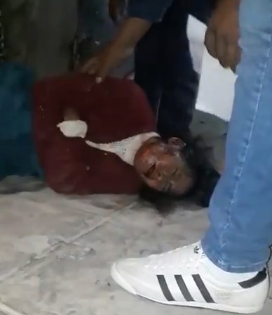 Woman Dying after being Stabbed During Fight with her Boyfriend