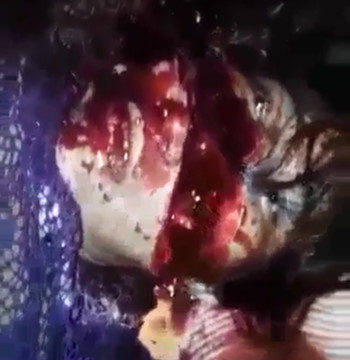 Disturbing Video Shows Woman Mutilated and her Face Ripped Off in Brutal Machete Attack