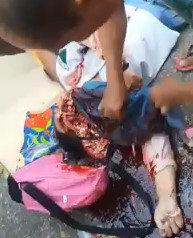 Collect and Put Skull Fragments and Brain Matter Into Plastic Bag