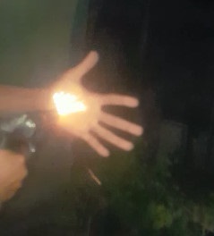 Thief Shot in Hand, Punishment Caught Thieving in Favela