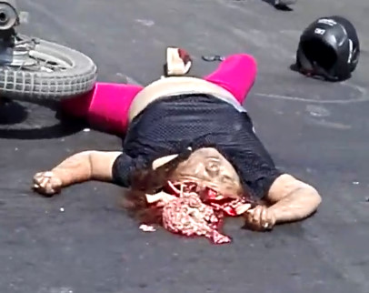 Helmet Didn't Work too Well...