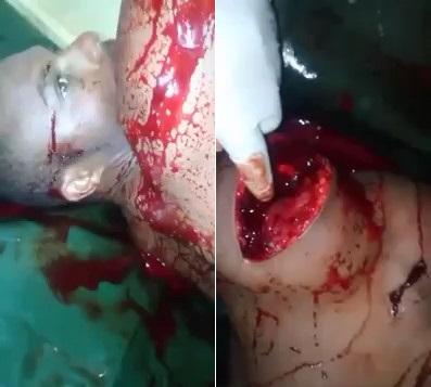 Man with Multiple Machete Slashes