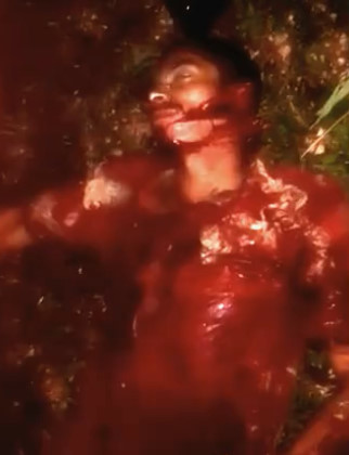 Dominican Man Dying in the Street After Machete Attack