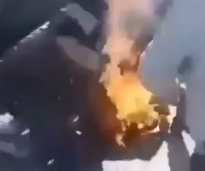 Sets Himself on Fire