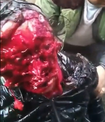 SHOCKING: Horrible Dog Attack Leaves Girl With Skinned Face! 