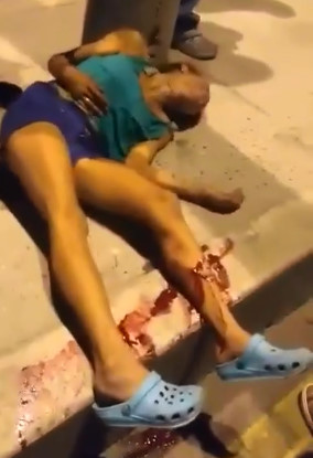 Woman Stabbed by Ex Boyfriend Dying From Wound in Agony