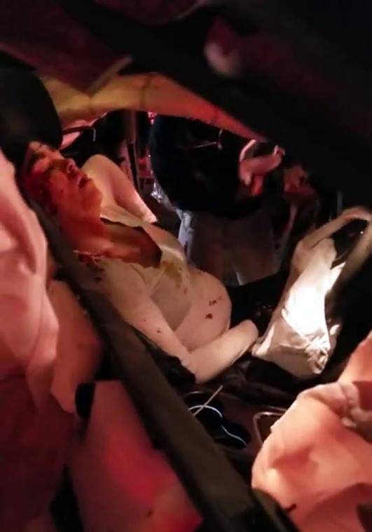 Female Driver in Rough Shape After Car Accident