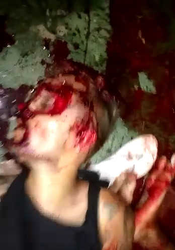 Bloody Murder Scene...