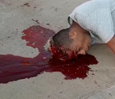 Dude Shot in the Head Takes his Last Dramatic Last Breathe of Air 