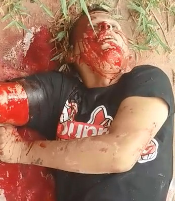 Up-Close Man Dying From Gunshot To The Head.