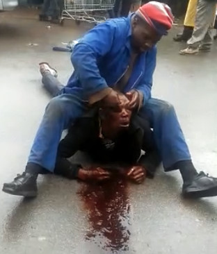 Drunk Man Gouges Friend's Eyes Out