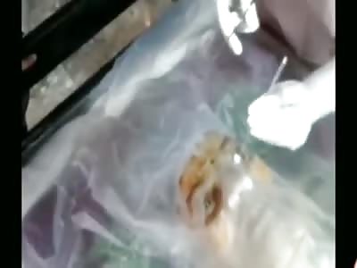 Postmortem -Eye Donation