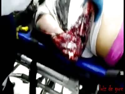 Teenager run over by recklees driver 3 part