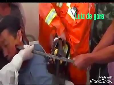 Man is inlaid a rod in the face