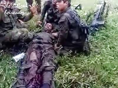 Soldier loses legs in minefield