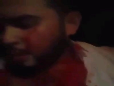 Man transmits live via facebock after being shot