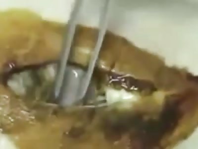 Krokodill drug sequences