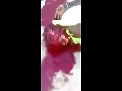  woman injured by pitbulll attack