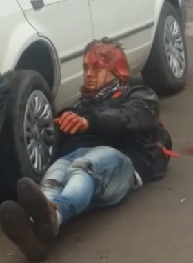 Bag Thief Partially Scalped in Motorcycle Crash