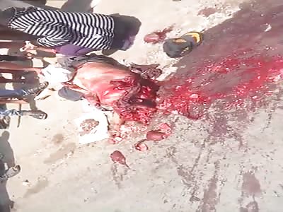 Mans head crushed in fatal accident with car.