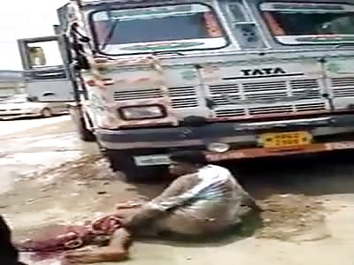 Mans leg hanging off after getting hit by truck.