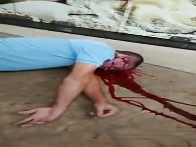 Man was shot in the head outside a supermarket