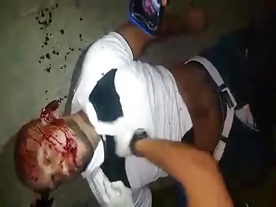 CPR on dead man after accident