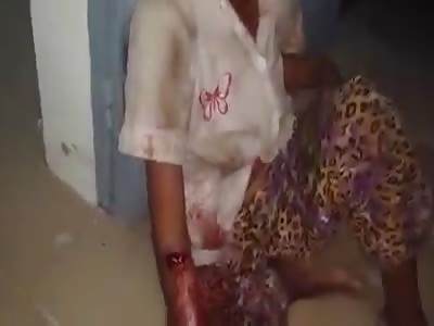 Woman and mans arms badly cut