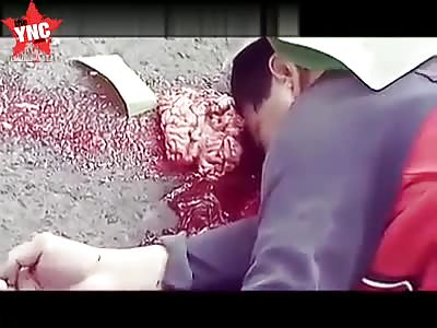 Scooping up brains after accident