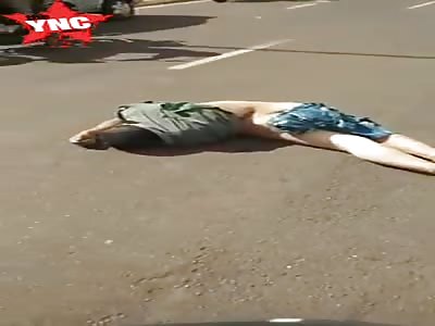 Womans body broken after accident