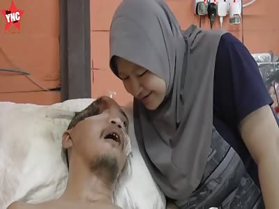 Man left with half a skull