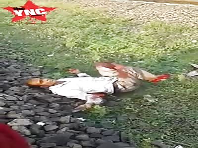 Mans leg was cut off by a train