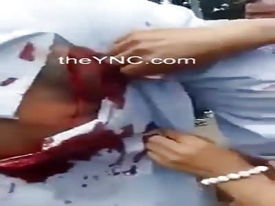 Taxi driver had his back slashed open with a knife