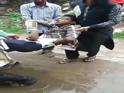 Man in shock after his hand was cut off by a train