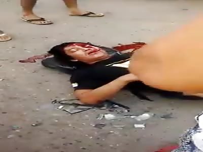 Mans head bleeding all over the street