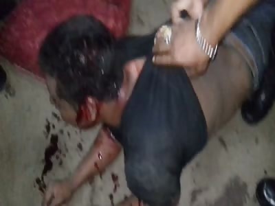 Thief covered in blood after being caught stealing from a market