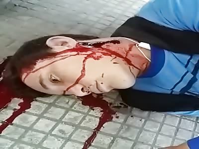 Blood Leaking out of Dying Thief  - Final Seconds of Life